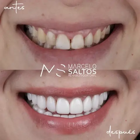 Caso clínico 15: antes y después del tratamiento